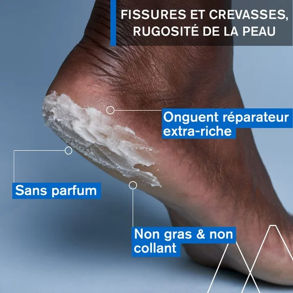 BARIÉDERM-CICA - Onguent Fissures Crevasses - Corps - Peaux Sensibles et Irritées, 40g