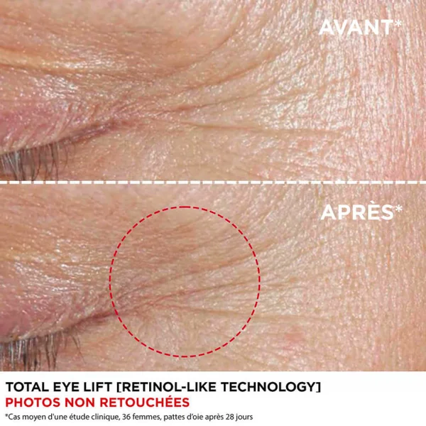 Clarins - Total Eye Lift Contour des yeux anti-âge rechargeable