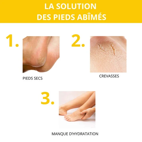 Crème Pieds Réparatrice au Miel de Manuka IAA15+ - Pieds Secs à Très Secs, 75ml