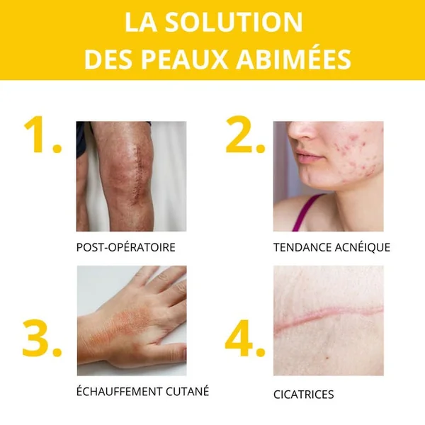 Crème Réparatrice au Miel de Manuka Bio - Peaux Abîmées, Irritées et Desséchées, 40ml