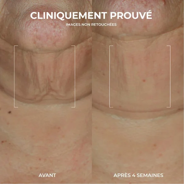 DERM CORREXION - Sérum Raffermissant en Stick - Visage - Tous Types de Peaux, 30g