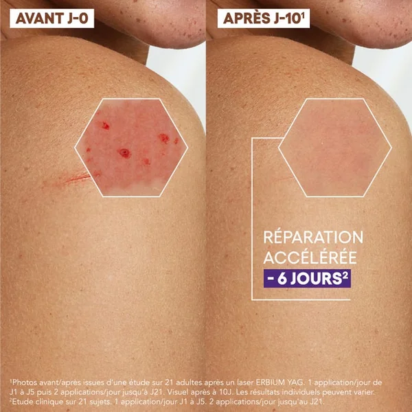 EPITHELIALE ULTRA REPAIR - Crème Réparatrice Anti-Marques - Visage et Corps - Peaux Fragilisées, 100ml