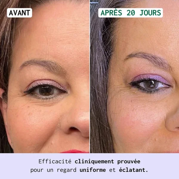 EYE RE-7 - Contour des Yeux Multi-Correcteur - Cernes, Poches et Rides - Tous Types de Peaux, 15ml