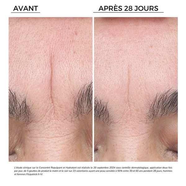 HYAL-FILLER - Concentré Repulpant et Hydratant 15% - Visage - Tous Types de Peaux, 30ml