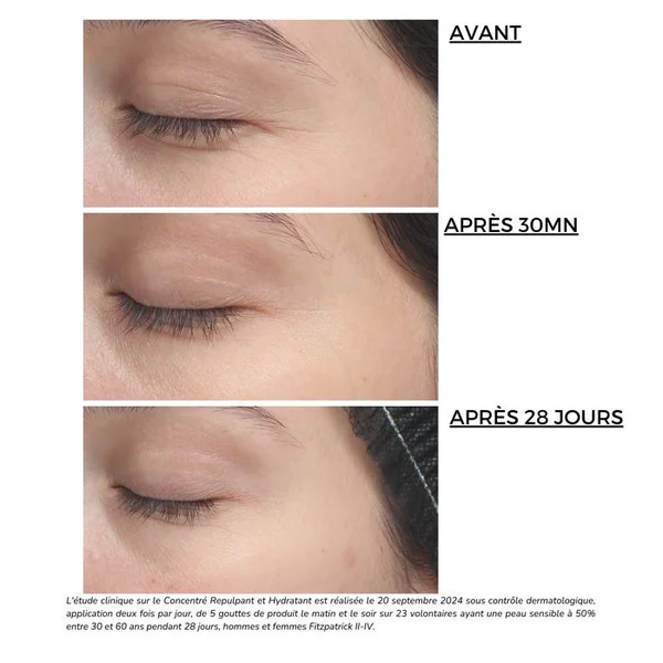 HYAL-FILLER - Concentré Repulpant et Hydratant 15% - Visage - Tous Types de Peaux, 30ml