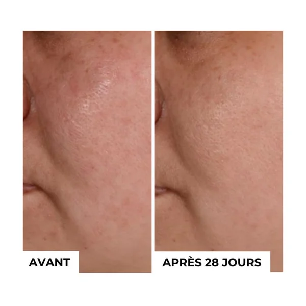 Masque Exfoliant Antioxydant Detox 2 en 1 - Tous Types de Peaux, 50ml