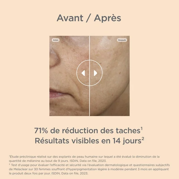 MELACLEAR - Sérum Anti-Taches - Visage - Tous Types de Peaux, 30ml