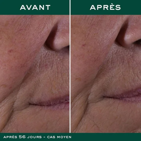 NUXURIANCE ULTRA - La Crème Anti-ge Global - Visage - Tous Types de Peaux, 50ml