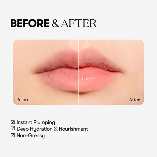 Reedle Shot Lip Plumper Beginner