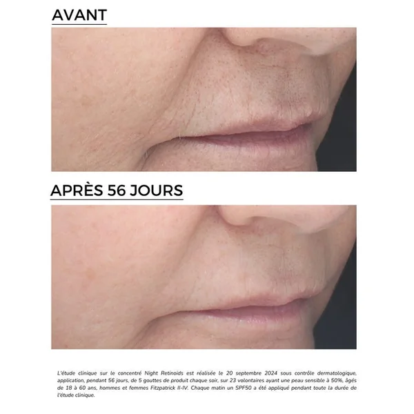 RETINAL - Concentré Rétinoïdes Nuit 6% - Visage - Tous Types de Peaux, 30ml