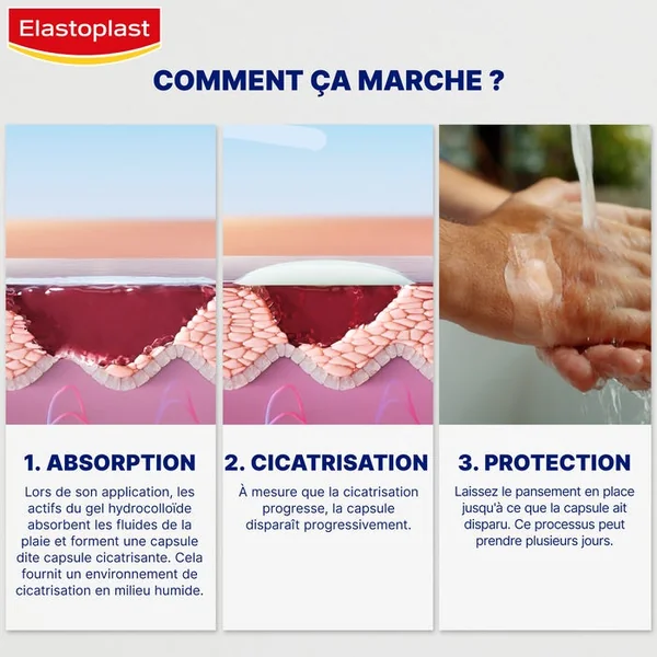SECOND SKIN PROTECTION - Pansement Bandage Ultra Fin et Flexible, 3 Unités