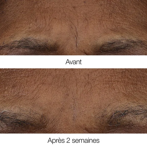 SMART CLINICAL REPAIR - Baume Rétinoïde Anti-Rides Matin et Soir - Visage - Tous Types de Peaux, 3.29g