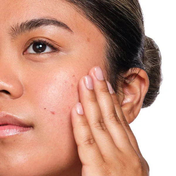 Solution à l'Acide Salicylique 2% - Sérum Anti-Imperfections - Visage - Peaux Grasses à Imperfections, 30ml