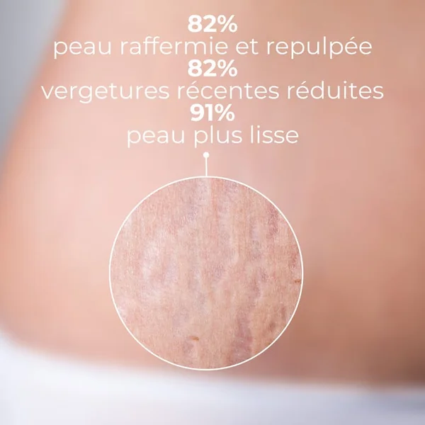 SPECIFIC PROTOCOLE - Soin Vergetures Raffermissant - Tous Types de Peaux, 200ml