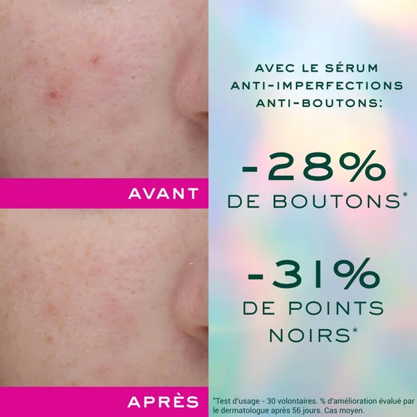 ZINC POWER - Sérum Anti-Imperfections Anti-Boutons - Visage - Peaux à Tendance Acnéique, 30ml